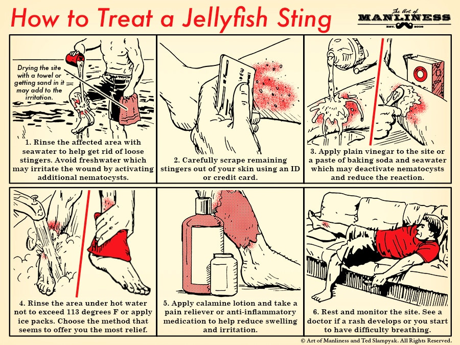 How To Treat A Jellyfish Sting | The Art Of Manliness