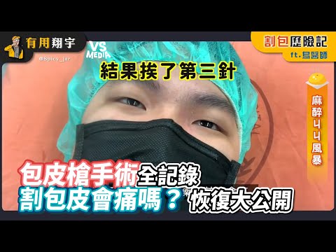 包皮槍手術全記錄 割包皮會痛嗎？ 恢復大公開｜VS MEDIAｘ有用翔宇.